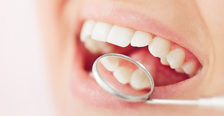 Thrush on store tonsils